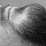 Imagen de barba de hombre